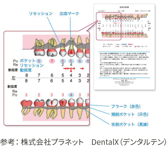 歯周病を科学する ビジュアル 歯周病を科学する - クインテッセンス出版